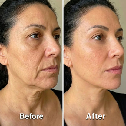 Mascarilla elevadora V-Sculpt